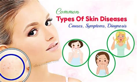 Top 7 Common Types Of Skin Diseases: Causes, Symptoms, Diagnosis