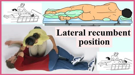 lateral recumbent position - YouTube