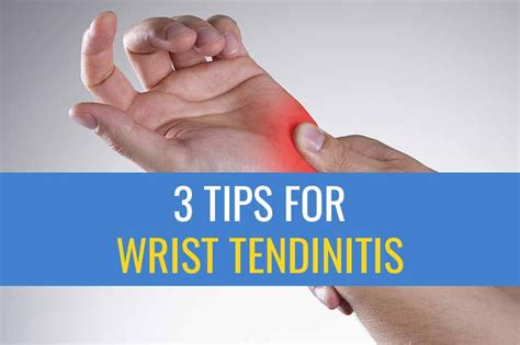 3 Tips for treating wrist tendinitis caused by computer work