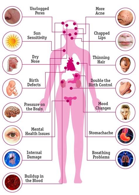 Accutane: What Are the Side Effects on the Body? | Best acne treatment ...