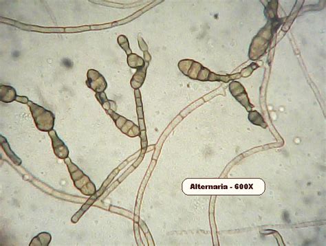 Mold Under Microscope