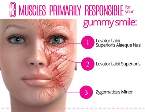 Gummy Smile Botox Treatment in Singapore - Dr Edwin Lim