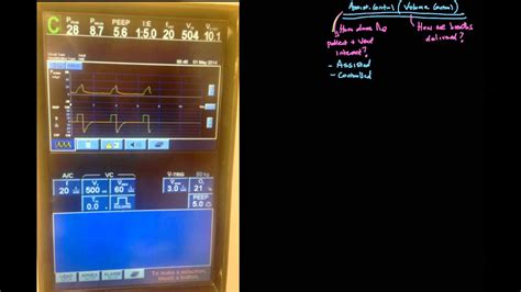 Principle of Mechanical Ventilation 5: Assist Control Volume Control - YouTube