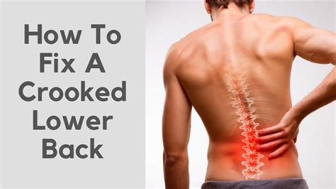 How To Fix A Crooked Spine - YouTube