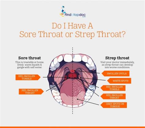 Sore Throat: Is it Viral or Bacterial? Know the Difference