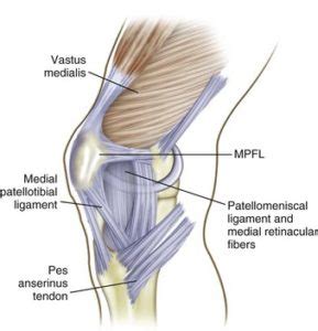 MPFL Reconstruction - SSORKCSSORKC