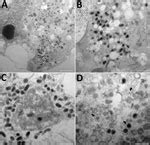 Human Infection with Orf Virus and Description of Its Whole Genome, France, 2017 - Volume 25 ...