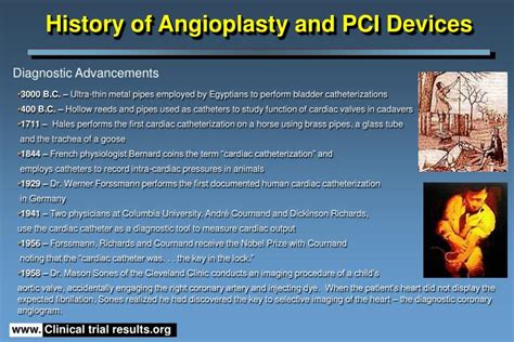 PPT - History of Angioplasty and PCI Devices PowerPoint Presentation ...