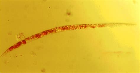 Microscopic image of a representative Steinernema feltiae nematode ...