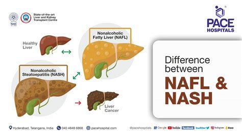 Difference between NAFLD and NASH | NAFLD vs NASH - YouTube