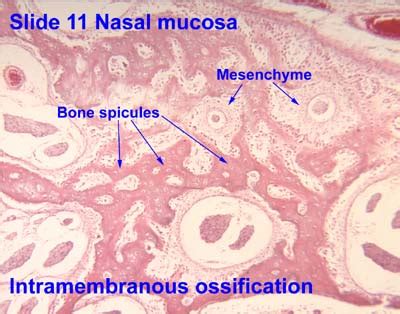 Woven Bone Histology