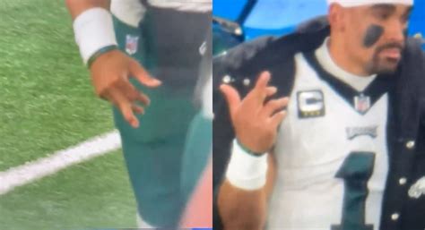 Jalen Hurts' Finger Pops Out Of Place During Gruesome Injury vs Giants - Daily Snark