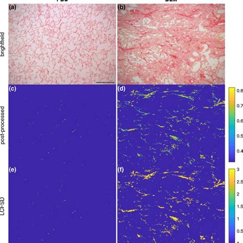 Examples of histology from Anathy et al. (2018). a Brightfield image of ...