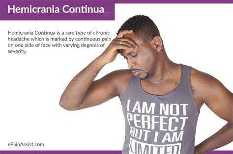 Hemicrania Continua (HC) Read More: http://www.epainassist.com/headache ...