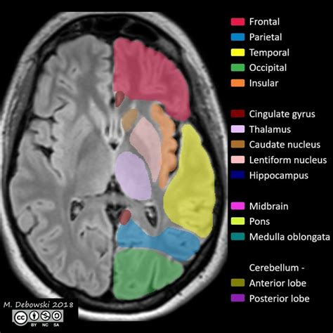 NEUROIMAGING IN IDENTIFYING DISORDERS