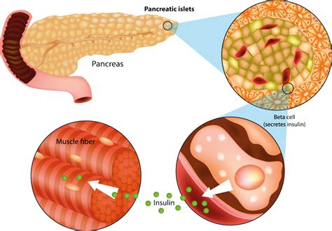 A focus on beta cell mass could help prevent type 2 diabetes - Research ...