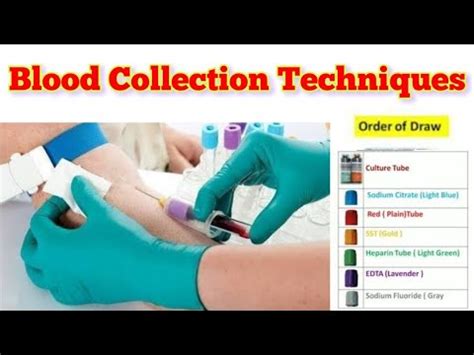 How To Collect Blood Sample | Phlebotomy Techniques - YouTube