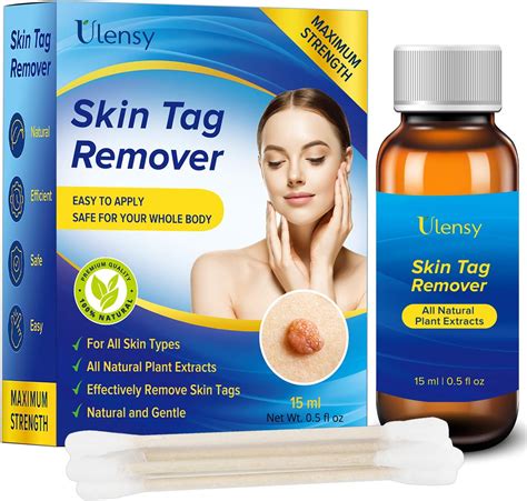 My Best Buy Hour: Before you Buy Micro Skin Tag Remover | Choose the ...