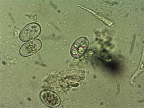 Coccidia - Troccap