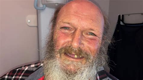 From three teeth to a full smile for this former homeless man | cbs8.com