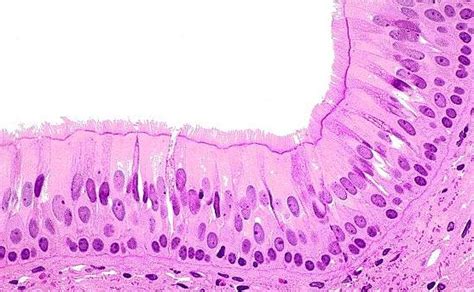 ciliated pseudostratified columnar epithelium with goblet cells | Histology slides, Tissue ...