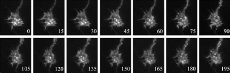 Actin dynamics in growth cones. The panels show a growth cone from an... | Download Scientific ...