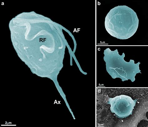 Scanning electron microcopy of the different forms of Trichomonas... | Download Scientific Diagram