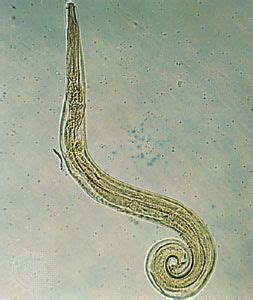 Pinworm | Intestinal Parasite, Infection & Treatment | Britannica