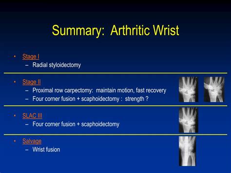 PPT - SLAC & SNAC wrists Management & Results PowerPoint Presentation ...