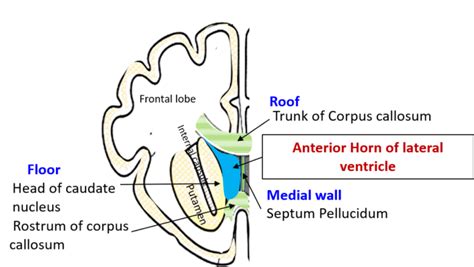 Lateral Ventricle - Anatomy QA