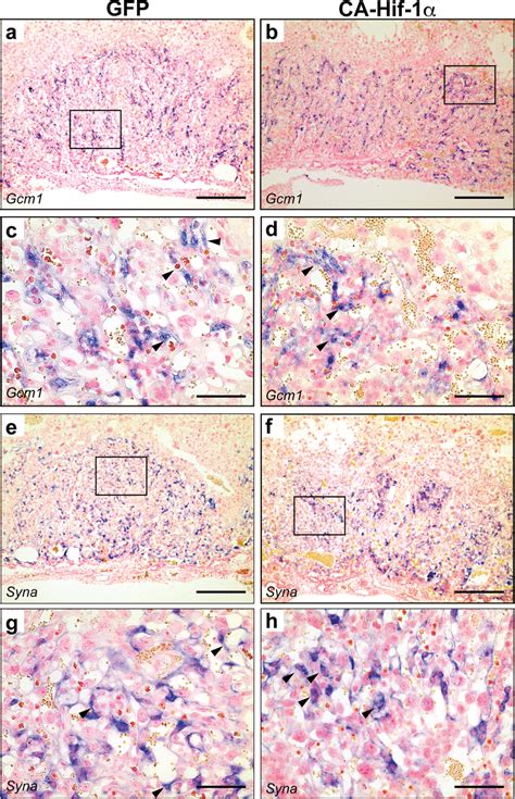 Expression of markers of syncytiotrophoblast demonstrated disorganized ...