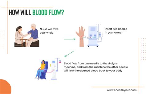 Exploring Dialysis: Hemodialysis Vs. Peritoneal Dialysis