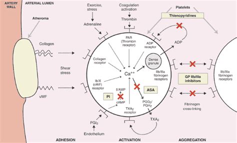 A Critical Appraisal Of Aspirin In Secondary Prevention, 60% OFF