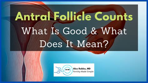 Antral Follicle Counts: What's Good & What Does It Mean? - Alex Robles, MD