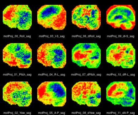 FMRI - Brain Mapping Unit