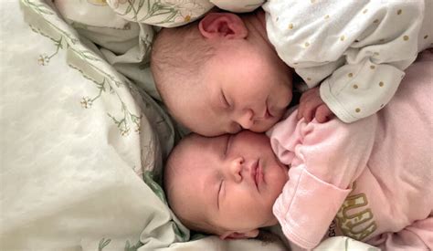 Study of Twins Shows It’s Genetics That Controls Abnormal Development