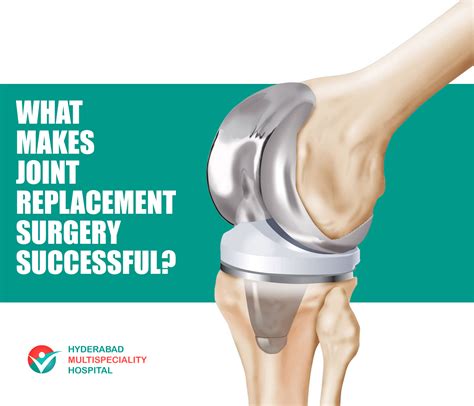 What makes Joint Replacement surgery Successful? - HYDERABAD MULTI SPECIALITY HOSPITAL BLOG