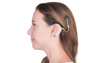 Cochlear Implants - AOPA