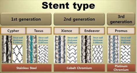 Stents: Functions, Characteristics, and Materials | Basicmedical Key