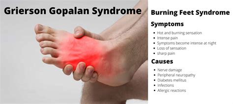 Grierson Gopalan Syndrome | Learn from doctor