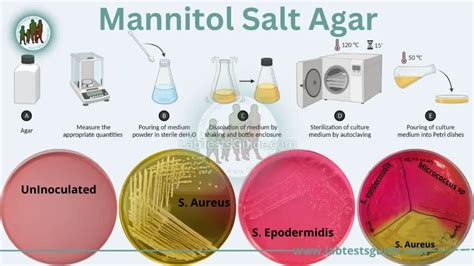 Mannitol Salt Agar Purpose, Principle, Composition, Preparation ...