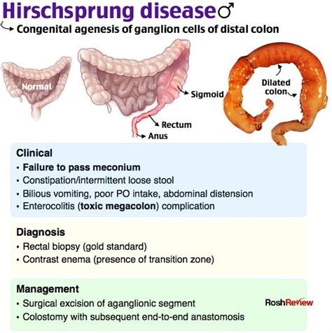 the diagram shows different types of human digests