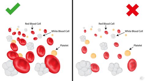 5 Signs You Have A Low Red Blood Cell Count | Power of Positivity