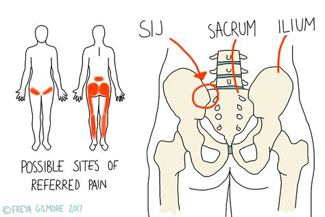 The Sacroiliac Joint (SIJ) - Beth Forrest Osteopathy