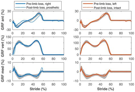 Transfemoral limb loss modestly increases the metabolic cost of optimal ...