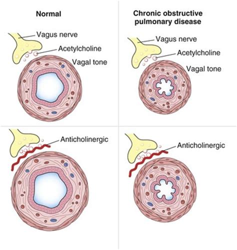 Bronchodilators | Thoracic Key