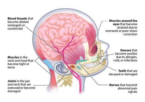 Neck Pain Base Of Head