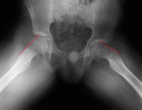 Pediatric Radiology