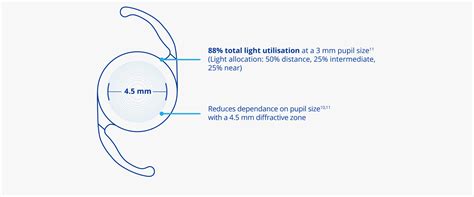 Clareon® Panoptix® Trifocal IOL | Alcon UK Professional