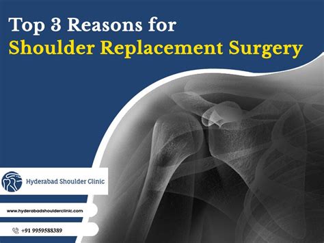 shoulder joint replacement surgery recovery time - shoulder clinic Hyderabad